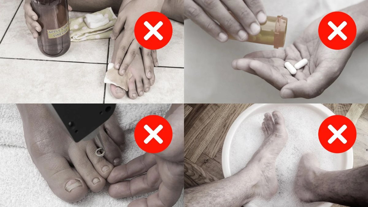 Lo que la mayoría prueba antes, casi siempre en este orden.